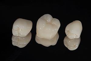 dental crowns in Waterford sitting on a countertop