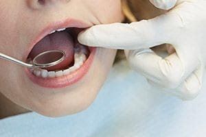 Closeup of child during dental exam